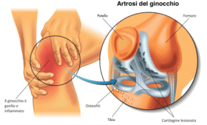 Immagine ginocchio