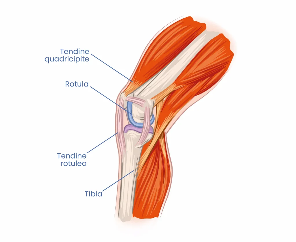tendinopatia-rotulea