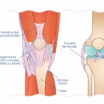 tendinopatia-rotulea-raffigurazione
