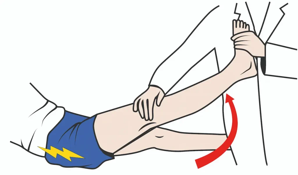 diagnosi-lombosciatalgia