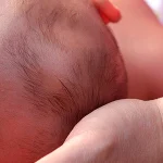 Fisiorehab360 | Fisioterapia e fisioterapia in acqua a Carrara | Plagiocefalia posizionale: prevenzione e trattamento